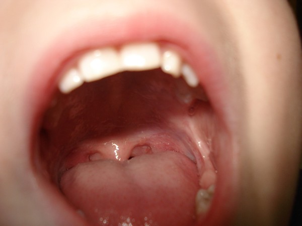 ▲嘴巴,牙齒,嘴唇,舌頭。（圖／取自免費圖庫Pixabay）