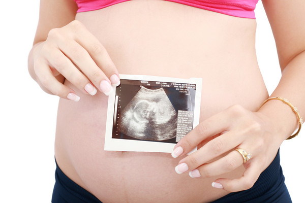 ▲產檢,懷孕,孕婦,妊娠,寶寶,超音波照片。（圖／達志／示意圖）
