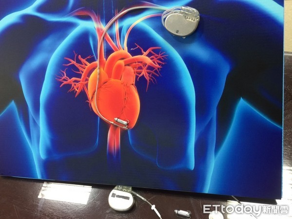 ▲新型無導線心臟節律器。（圖／記者林悅攝）