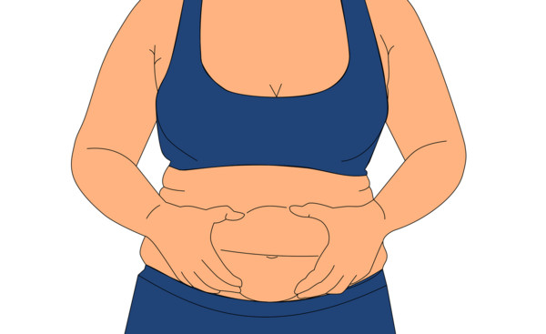 ▲肥胖,運動,減肥,女性。（圖／翻攝自pixabay）