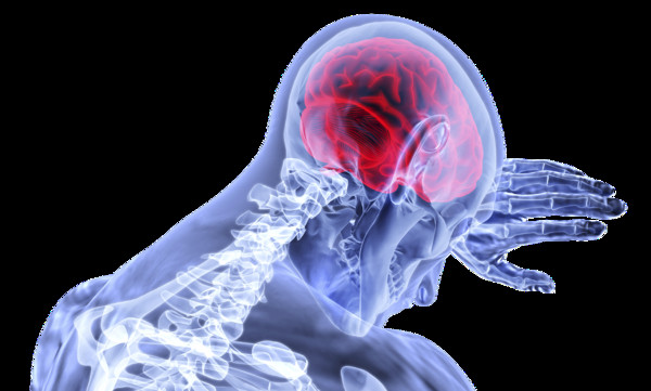 ▲▼ 大腦,頭痛,。（圖／免費圖庫pixabay）