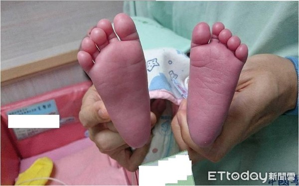 ▲▼中國附醫新生兒科今年至今已收3名嬰幼兒罹患川崎症案例，醫師林鴻志提醒家長當心。（圖／中國附醫提供）