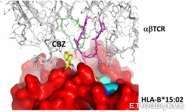 Carbamazepine(卡馬西平,簡稱CBZ)藥物和HLA-B*15:02，T細胞受體（TCR）結合之示意圖。（圖／長庚醫院提供）