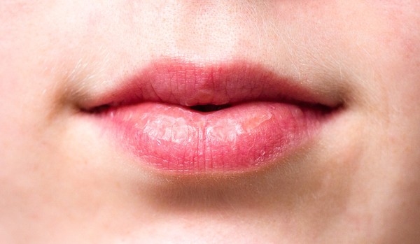▲唇,嘴唇,唇紋,唇裂,嘴唇脫皮。（圖／pixabay）